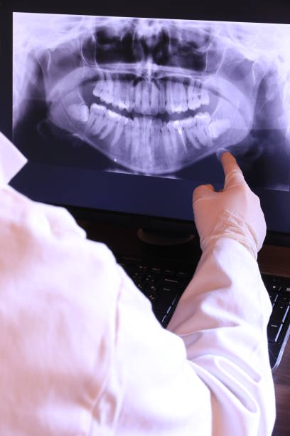 Best Emergency Dental Extractions in Pilot Point, TX