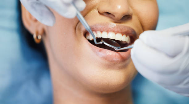 Best Emergency Dentist for Knocked-Out Tooth in Pilot Point, TX